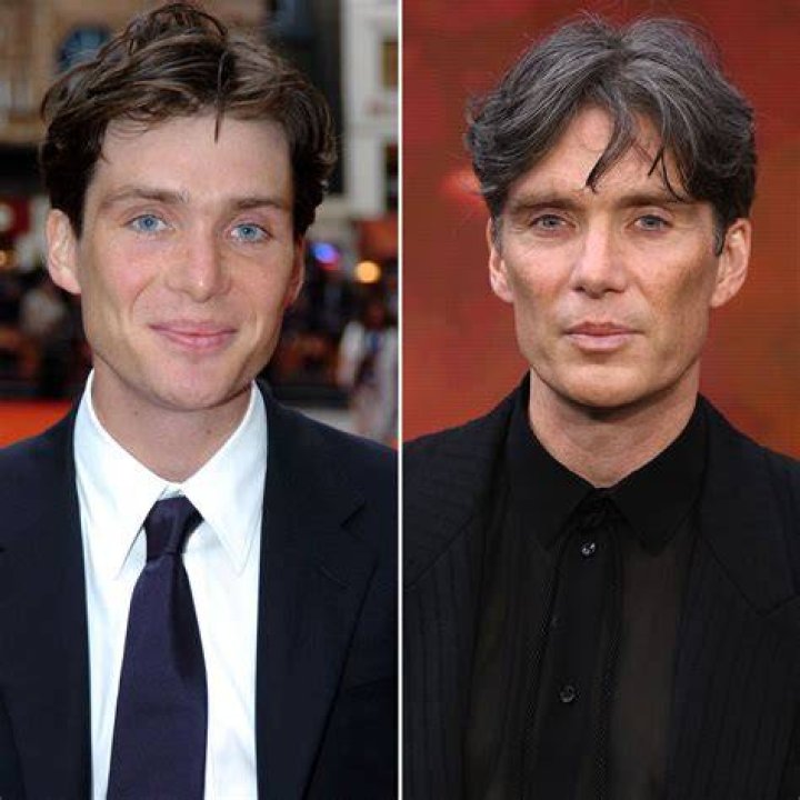 Has Cillian Murphy Had Plastic Surgery? See ‘Oppenheimer’ Star’s